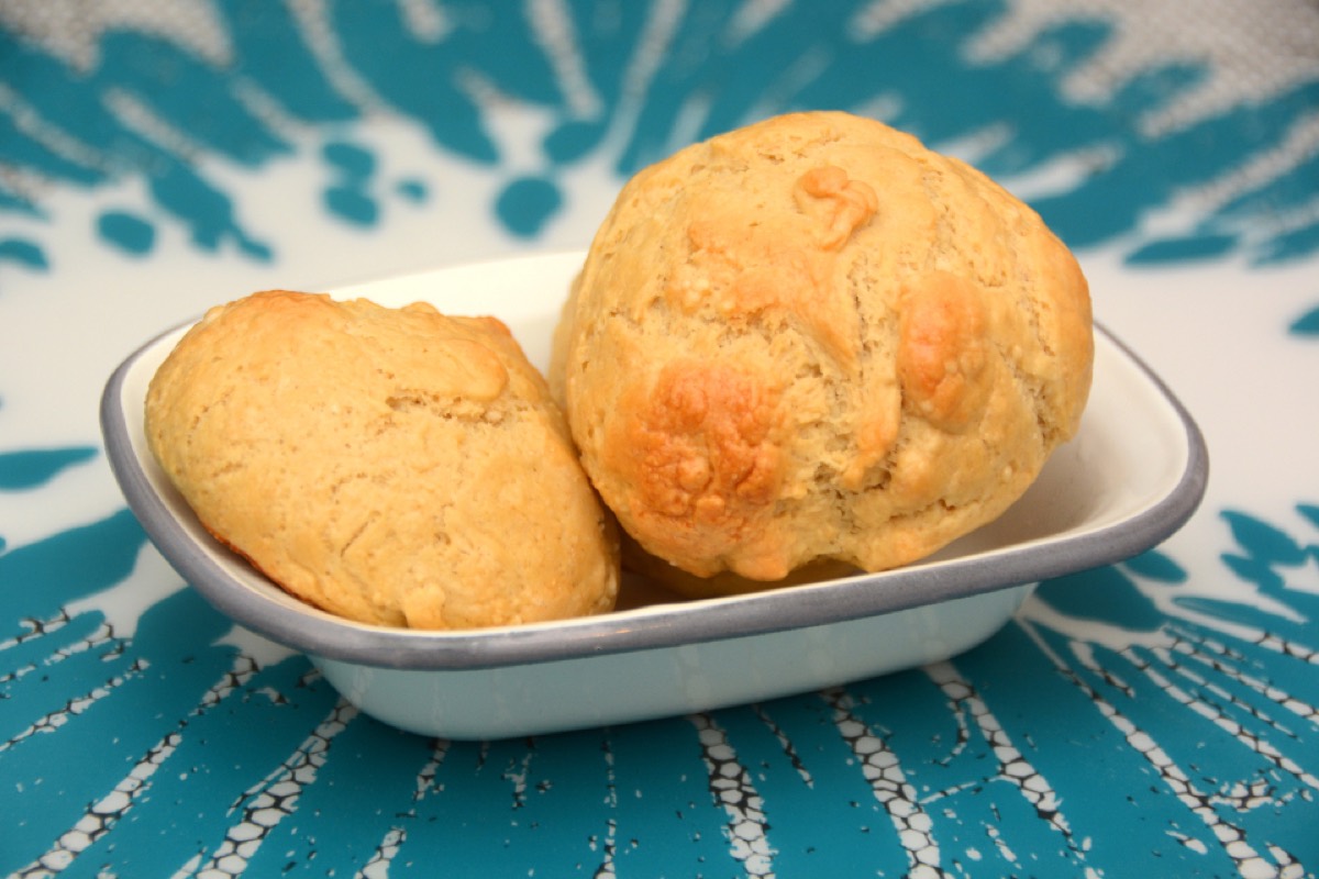 Gluten, dairy and sugar — common psoriasis triggers